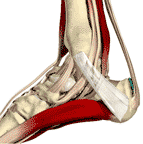 Tarsal Tunnel - Heal or Big Toe Pain and applied kinesiology - image of ankle skeletal and muscular structure