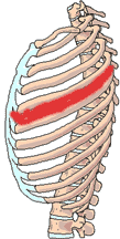 Intercostal Neuritis Neuralgia and applied kinesiology - image of the side of the rib cage and spine skeletal structure